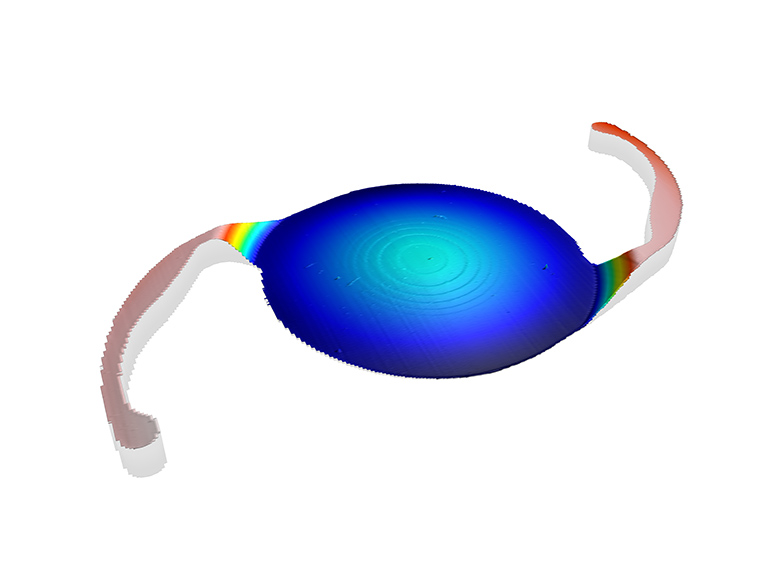 IOL Topographie mit Liniensensor CLS aufgenommen